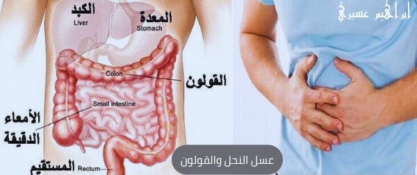 عسل النحل والقولون